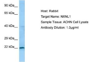 Western Blotting (WB) image for anti-Nucleoredoxin Like Protein 1 (NXNL1) (N-Term) antibody (ABIN2790127) (NXNL1 antibody  (N-Term))