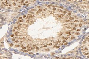 Immunohistochemistry analysis of paraffin-embedded mouse testis using,TEX11 (ABIN7075862) at dilution of 1: 2000 (TEX11 antibody)