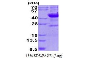 Sialidase 1 (Lysosomal Sialidase) (NEU1) (AA 48-415) protein (His tag)