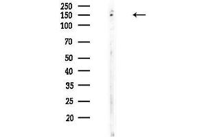 anti-Solute Carrier Family 4, Anion Exchanger, Member 3 (SLC4A3) (N-Term) antibody