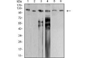 Western blot analysis using SMARCA1 mouse mAb against PANC-1 (1), HEK293 (2), SW620 (3), HT-29 (4), SH-SY5Y (5), and SK-OV-3 (6) cell lysate. (SMARCA1 antibody  (AA 933-1070))