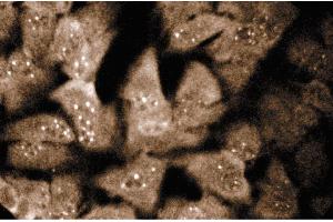 Immunofluorescence staining of HeLa cells (Human cervical epitheloid carcinoma, ATCC CCL-2. (SNRPN antibody  (AA 14-174))