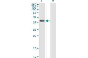 Western Blot analysis of NDRG2 expression in transfected 293T cell line by NDRG2 monoclonal antibody (M03), clone 6A5.