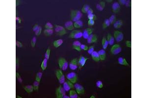 Human HeLa cells stained with ABIN1580459 (red), chicken antibody to vimentin CPCA-Vim (green) and DNA (blue, stained with DAPI). (SF3B4 antibody)