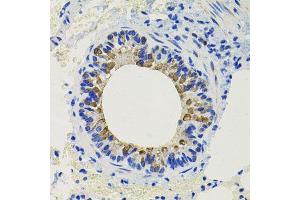 Immunohistochemistry of paraffin-embedded mouse lung using CALB2 antibody (ABIN6003539) at dilution of 1/100 (40x lens). (Calretinin antibody)