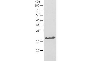 PDCD6 Protein (AA 1-191) (His tag)