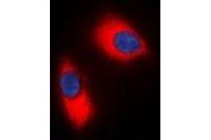 Immunofluorescent analysis of p47 phox staining in Jurkat cells. (NCF1 antibody  (C-Term))