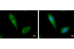 ICC/IF Image NDUFA10 antibody [N1C3] detects NDUFA10 protein at cytoplasm by immunofluorescent analysis. (NDUFA10 antibody  (Center))