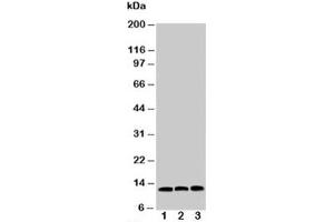 Western blot testing of MIF antibody and Lane 1:  HeLa (MIF antibody  (C-Term))