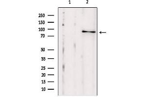 Western blot analysis of extracts from HepG2, using SEC5/EXOC2 antibody.