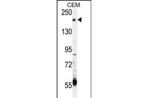 Western blot analysis in CEM cell line lysates (35ug/lane). (TRPM6 antibody  (AA 317-348))