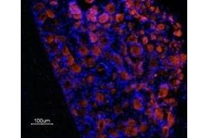 Expression of Prokineticin receptor 1 in rat DRG - Immunohistochemical staining of frozen rat dorsal root ganglion (DRG) sections using Anti-Prokineticin Receptor 1 (extracellular) Antibody (ABIN7043560 and ABIN7045110), (1:100), followed by Alexa-555-conjugated goat anti-rabbit secondary antibody. (Prokineticin Receptor 1 antibody  (Extracellular, N-Term))