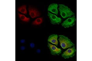 ABIN6262381 and ABIN6279014 staining Hela cells by IF/ICC.