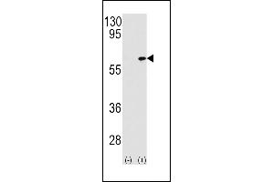 Western blot analysis of P3K7IP1 (arrow) using rabbit polyclonal P3K7IP1-p (ABIN390845 and ABIN2841072). (TAB1 antibody  (AA 401-430))