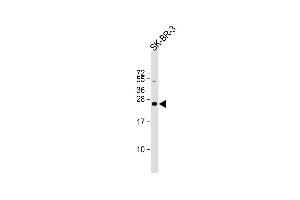 Anti-DERL1 Antibody (C-term) at 1:16000 dilution + SK-BR-3 whole cell lysate Lysates/proteins at 20 μg per lane.