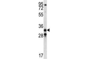 GDF15 antibody western blot analysis in NCI-H460 lysate (GDF15 antibody  (AA 51-79))