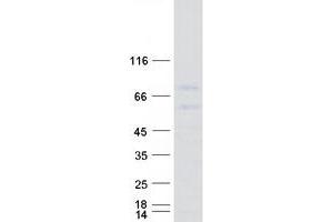 Western Blotting (WB) image for Proprotein Convertase Subtilisin/kexin Type 9 (PCSK9) protein (Myc-DYKDDDDK Tag) (ABIN2728448)