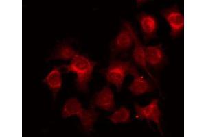 ABIN6272397 staining LOVO by IF/ICC. (POLR3B antibody  (C-Term))