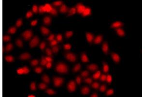 Immunofluorescence analysis of  cells using MLF1 antibody (ABIN6128237, ABIN6143874, ABIN6143876 and ABIN6217281). (MLF1 antibody  (AA 1-268))