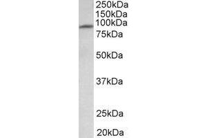Western Blotting (WB) image for anti-Major Facilitator Superfamily Domain Containing 6 (MFSD6) (Internal Region) antibody (ABIN2465065) (MFSD6 antibody  (Internal Region))