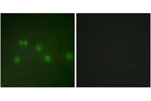 Immunofluorescence analysis of HuvEc cells, using COT2 Antibody. (Grr1p antibody  (AA 1-50))