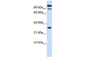 PTPRE antibody used at 1 ug/ml to detect target protein. (PTPRE antibody  (Middle Region))