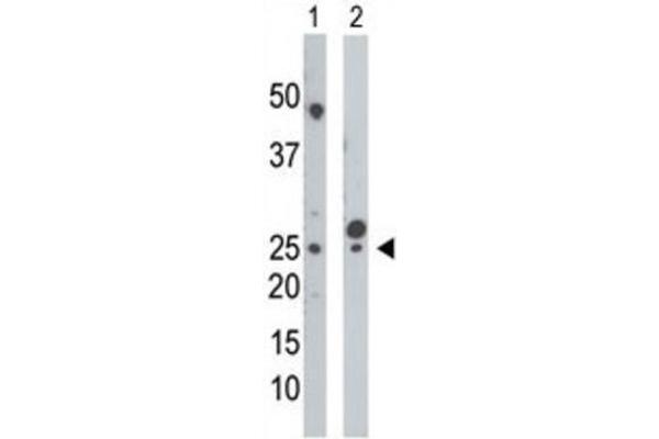 UCK antibody