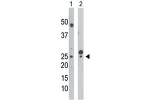 Western Blotting (WB) image for anti-Uridine-Cytidine Kinase (UCK) antibody (ABIN3003699) (UCK antibody)