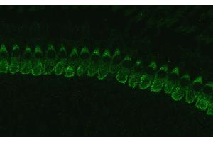 Otoferlin antibody  (Isoform 1)