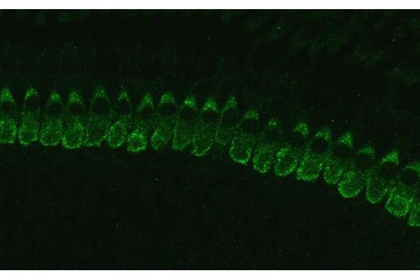 Otoferlin antibody  (Isoform 1)