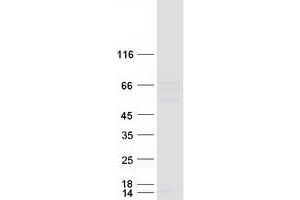 Validation with Western Blot (CETP Protein (Myc-DYKDDDDK Tag))