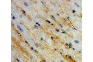 Used in DAB staining on fromalin fixed paraffin-embedded Heart tissue (PCOLCE antibody  (AA 38-449))