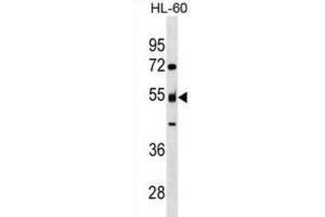 Western Blotting (WB) image for anti-Nucleosome Assembly Protein 1-Like 2 (NAP1L2) antibody (ABIN3000094) (NAP1L2 antibody)