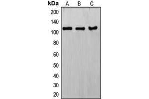 Western blot analysis of ERCC4 expression in HeLa (A), KNRK (B), MCF7 (C) whole cell lysates.