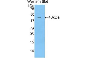 Western blot analysis of the recombinant protein. (BPI antibody  (AA 320-456))