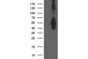 HEK293T cells were transfected with the pCMV6-ENTRY control (Left lane) or pCMV6-ENTRY CCM2 (Right lane) cDNA for 48 hrs and lysed. (CCM2 antibody)