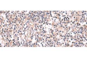 Immunohistochemistry of paraffin-embedded Human tonsil tissue using GSPT2 Polyclonal Antibody at dilution of 1:50(x200) (GSPT2 antibody)