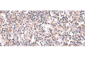 Immunohistochemistry of paraffin-embedded Human tonsil tissue using GSPT2 Polyclonal Antibody at dilution of 1:50(x200) (GSPT2 antibody)