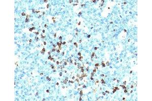 IHC testing of human tonsil stained with Lambda light chain antibody cocktail (LcN-2 + ICO-106). (Mouse anti-Human lambda Light Chain (Lambda-IgLC) Antibody)