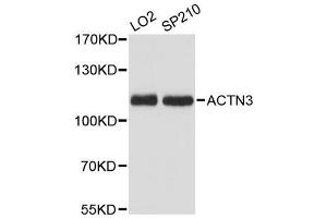 Western blot analysis of extracts of various cell lines, using ACTN3 antibody. (ACTN3 antibody  (AA 580-630))