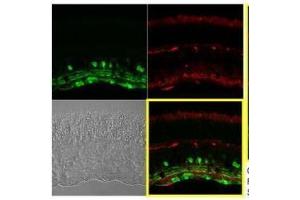 IHC-P Image Immunohistochemical analysis of paraffin-embedded Mouse retina, using Calretinin, antibody at 1:250 dilution. (Calretinin antibody)