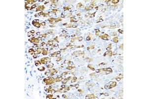 Immunohistochemistry of paraffin-embedded mouse stomach using MGP antibody at dilution of 1:100 (40x lens). (MGP antibody)