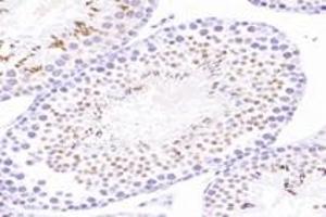 Immunohistochemistry analysis of paraffin-embedded mouse testis using,ACRBP (ABIN7072890) at dilution of 1: 8000 (ACRBP antibody)