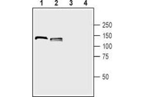 Western blot analysis of rat (lanes 1 and 3) and mouse (lanes 2 and 4) brain lysates: - 1,2.