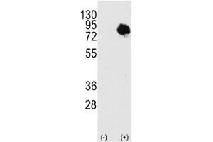 Western blot analysis of TG2 antibody and 293 cell lysate (2 ug/lane) either nontransfected or transiently transfected with the TGM2 gene. (Transglutaminase 2 antibody  (AA 413-442))
