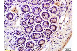 Formalin-fixed and paraffin embedded mouse colon labeled with Anti-CD158b2 Polyclonal Antibody, Unconjugated (ABIN748448) at 1:200 followed by conjugation to the secondary antibody and DAB staining. (KIR2DL3 antibody  (AA 42-140))