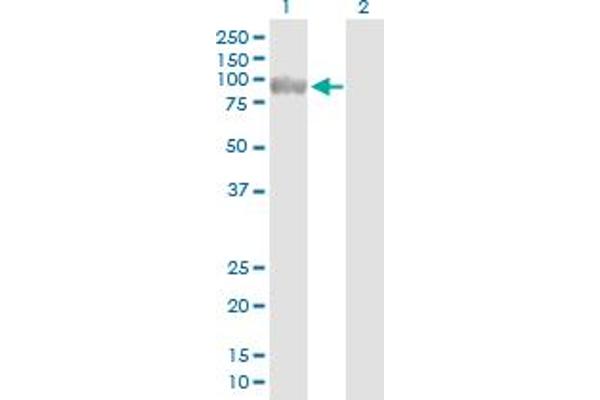Crossover junction endonuclease EME1 (EME1) (AA 1-583) antibody