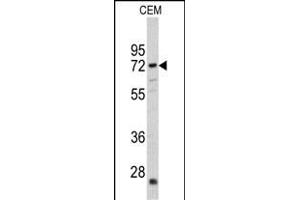 Western blot analysis of CRAT antibody (N-term) (ABIN390481 and ABIN2840845) in CEM cell line lysates (35 μg/lane). (CRAT antibody  (N-Term))