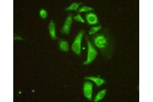 IHC-P analysis of HeLa cells, with FITC staining. (MAP4 antibody  (AA 2-250))