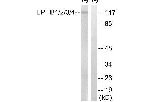 Western blot analysis of extracts from 3T3 cells, treated with heat shock, using EPHB1/2/3/4 (Ab-600/602/614/596) antibody. (EPH Receptor B1/2/3/4 (Tyr600) antibody)